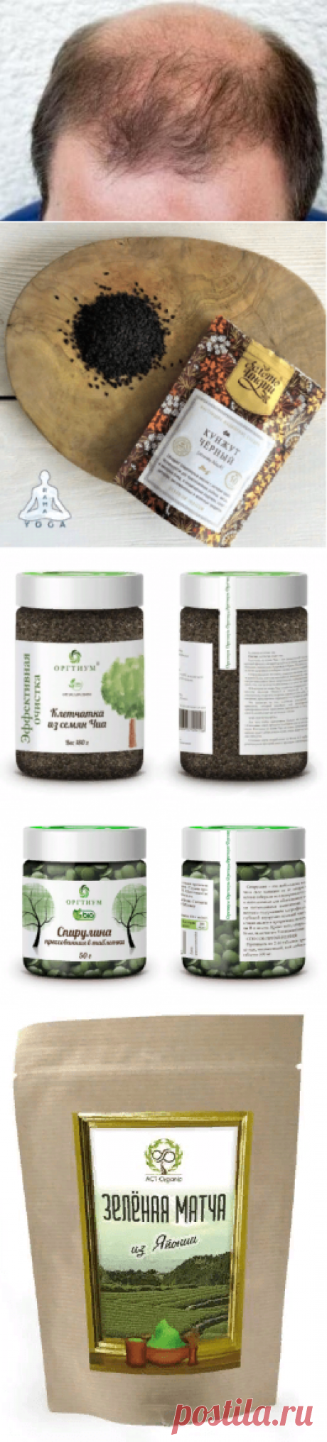 Диета при выпадении волос — как бороться с облысением?