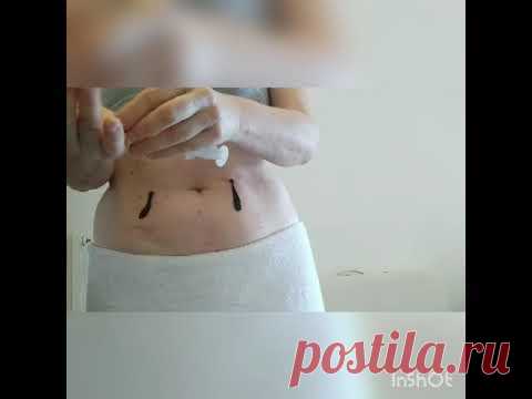 Пиявки на живот.Часть 2. Область тонкого кишечника, двенадцатиперстная кишка, поджелудочная железа.