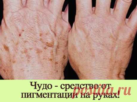 (51) Одноклассники