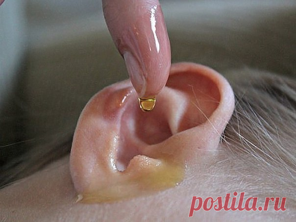Ушная сера — желтое смолянистое вещество, вырабатывающееся в ушном канале, которое выполняет функцию природного антисептика и помогает вывести из уха отмерший эпителий. Часть серы выводится наружу в результате жевания или зевания, а часть остается.

Привычка очищать уши ватными палочками чревата утрамбовкой серы, что может привести к образованию серной пробки. Также неаккуратным движением ты рискуешь повредить барабанную перепонку.

От чрезмерного скопления серы в ухе може...