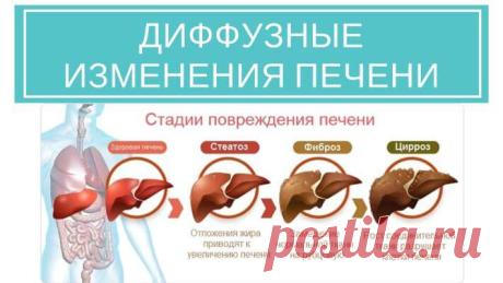Диффузные изменения печени. Причина. Симптомы. Как избавиться?
#здоровье #семья #диета #красота #медицина #зож #правильное #питание #здоровое #правильноепитание #пищеварение #печень #детокс #детоксикация #лайфхак #центрсоколинского