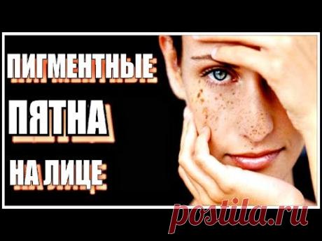 Готовим ОТБЕЛИВАЮЩИЙ ЛОСЬОН от пигментных ПЯТЕН и веснушек на лице.