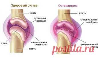 Суставы