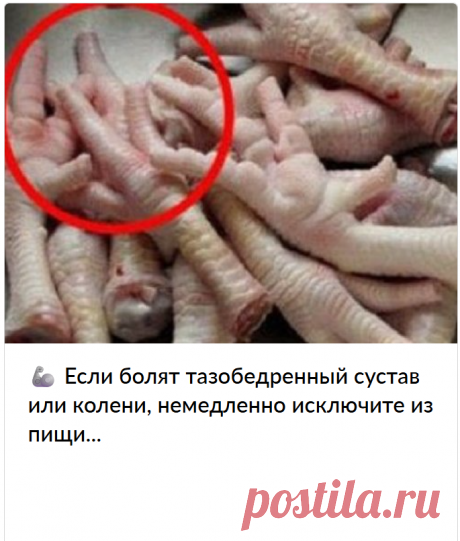 🦾 Если болят тазобедренный сустав или колени, немедленно исключите из пищи...