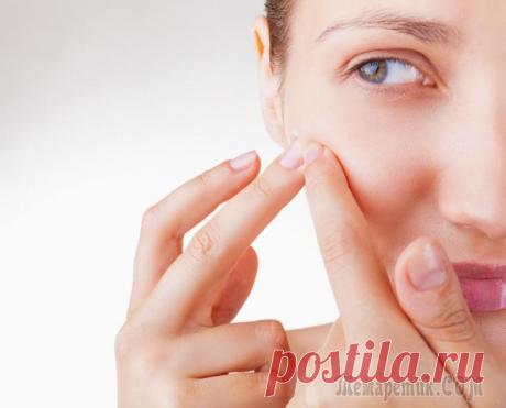 Как избавиться от прыщей народными средствами. Имбирные маски от прыщей в домашних условиях Несмотря на то, что имбирь обычно используют для приготовления пикантных блюд, он также способен творить чудеса как народное средство для лечения прыщей, рубцов от угревой сыпи и множества разных меди...