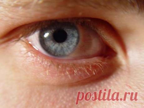 Как быстро избавиться от ячменя на глазу 🚩 как быстро от ячменя избавиться 🚩 Лечение болезней