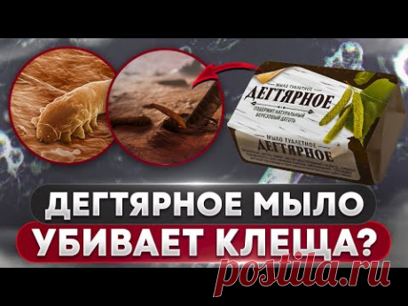 🧼 Дегтярное мыло против клеща? | Угревая Железница Demodex