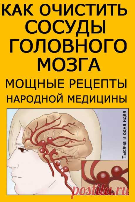 КАК ОЧИСТИТЬ СОСУДЫ ГОЛОВНОГО МОЗГА ? МОЩНЫЕ РЕЦЕПТЫ НАРОДНОЙ МЕДИЦИНЫ! | Тысяча и одна идея