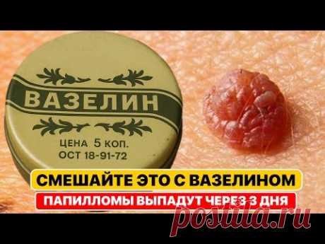 Папилломы, бородавки высохнут и отпадут сами! Нужно всего лишь добавить в вазелин одну вещь