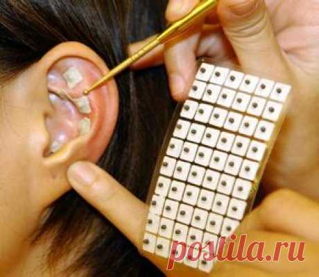 игла в ухо для похудения Игла для похудения.+7-931-360-16-23.Аурикулярная рефлексотерапия от аппетита в Спб!  Хотите похудеть,убрать живот?Снизить вес и укрепить мышечный тонус,  Тогда Вам поможет аурикулярная иглотерапия на Академической!Запись +7-931-360-16-23.  Врач иглорефлексотерапевт в Спб у м.Академическая успешно применяет метод акупунктуры для похудения и подавления аппетита.Аурикулярная акупунктура включает в себя установку клипм-кнопок в район ушных раковин.