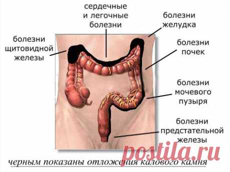 Правила, как  сделать так, чтоб кишечник работал как часы.
Обязательно с утра выпейте стакан чистой воды.
Обязательно завтракайте.
Обязательно удаляйте шлаки.
Обязательно насыщайте организм полезными бактериями-
