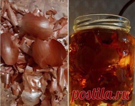 Волосы перестали выпадать

Ежедневное выпадение волос является естественным процессом. Но что, если волос стало в разы меньше, а на голове виднеются залысины

Литровую банку плотно набить луковой шелухой, залить вод - кой , добавить один пакетик гвоздики.

Держать 10 дней в темном месте, периодически встряхивая.
Перед мытьем головы тампоном смазывать корни волос этой настойкой.

Затем накрыть голову полиэтиленовой пленкой (у меня шапочка для душа) и укутать на 2-3 часа теп...