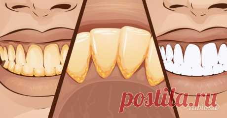 Как избавиться от зубного камня в домашних условиях. Рецепт очень прост! | Милая Я