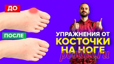 Упражнения от косточки на ноге, гимнастика для большого пальца ноги / Вальгусная деформация. ✅ Регистрируйтесь на мой 2-дневный бесплатный онлайн-курс "ДЕТОКС: комплексное очищение и восстановление организма": https://gc.ksamata.ru/detoks?utm_source=...
