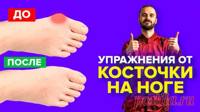 Упражнения от косточки на ноге, гимнастика для большого пальца ноги / Вальгусная деформация. ✅ Регистрируйтесь на мой 2-дневный бесплатный онлайн-курс 