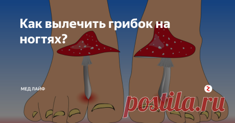 Как вылечить грибок на ногтях? Вы опасаетесь заражения ногтей грибковым заболеванием?
Может быть, ваши ногти уже поражены грибком?
У них неровная бугристая поверхность, они ломкие, крошатся, под ними образуется порошкообразный налёт?
Возможно они изменили здоровый розовый цвет на желтоватый и даже коричневый?