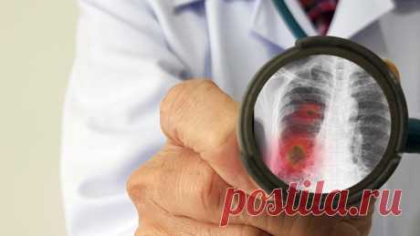 Эффективное восстановление лёгких после COVID-19
Covid-19 истощает организм и негативно отражается на состоянии дыхательной системы. Победив болезнь, важно знать, как восстановить лёгкие после коронавируса. Самые действенные методы мы уместили в несколько абзацев для вашего удобства. источник: Shutterstock Общие сведения о коронавирусе Новый вид вируса 2019-ncoV был зафиксирован в декабре 2019 года в Китае в городе Ухань, и весьма быстро адаптировался […]
Читай дальше на сайте. Жми подробнее ➡