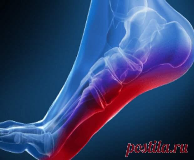 Упражнения от боли в стопе и пятке
Причиной боли в ногах может быть заболевание под названием подошвенный фасциит. Это воспаление ткани, проходящей по нижней стороны стопы и соединяющей пальцы ног и пятку. Как избавиться от болей в ногах? Правильное растяжение и гимнастика помогут справиться с проблемой.         Почему многие люди жалуются на боли в ногах? Причиной может быть подошвенный фасциит. Эта болезнь вызвана […]
Читай пост далее на сайте. Жми ⏫ссылку выше