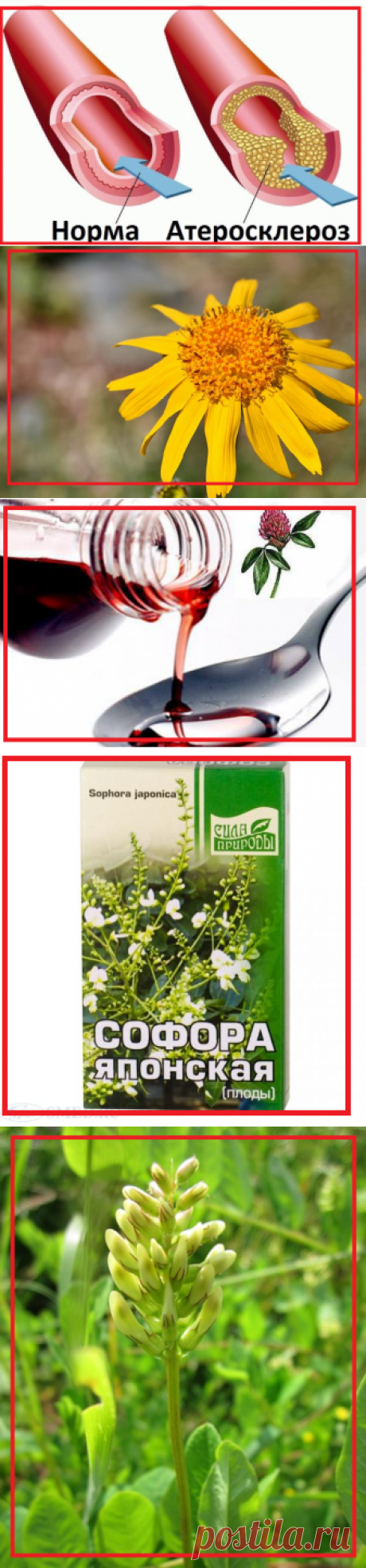 Как бороться с опасным атеросклерозом народными средствами | моя записная книжка | Яндекс Дзен