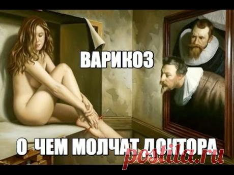 ВАРИКОЗ и тренировка мышц ГОЛЕНИ - Второе СРЕДЦЕ - ВАЖНО для ВСЕХ