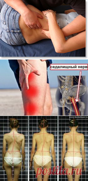 Вылетел диск в позвоночнике-помощь врача мануального терапевта в Санкт Петербурге.Опыт более 16 лет! В результате травмы или хирургического вмешательства у многих людей возникает боль в спине, которая может продолжаться длительное время.
Многие люди из-за этого сильно мучаются и не знают как от нее избавиться.
Боль в спине может быть вызвана различными причинами - это может быть мышечный спазм, ущемление нервных корешков, воспалительный процесс.
Поэтому лечение должно быть направлено на устран…