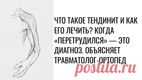 Что такое тендинит и как его лечить? Когда «перетрудился» — это диагноз. Объясняет травматолог-ортопед | Доктор Скипенко Т. О. - движение сустава на 360° | Дзен