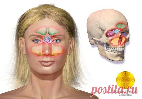 КАК БЫСТРО ИЗБАВИТЬСЯ ОТ НАСМОРКА. 

Синуситы и гаймориты — штука очень неприятная и нередко болезненная. Начиная от постоянного давления в голове и заканчивая хлюпающим носом, воспалённым горлом и температурой, этот недуг способен любого выбить из колеи. Но если эта напасть одолела вас или кого-то из ваших близких, не спешите бежать в аптеку, лучше попробуйте один из следующих способов: 

Вариант А: Надавите на брови. 

Если вас донимает заложенный нос, этот простой спосо...