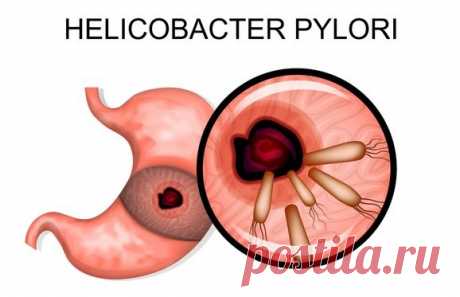 - Helicobacter pylori - как бороться естественным способом без лекарств -