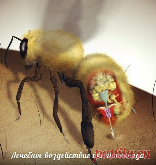 Лечебное воздействие пчелиного яда 
 
1. На нервную систему: 
• В малых дозах обладает возбуждающим, в больших успокаивающим эффектом. 
• Увеличивает выработку эндогенных опиоидов (эндорфины и энкефалины). 
• Выраженное обезболивающее действие. 
• Противосудорожная активность. 
• Улучшает проводимость нервного импульса. 
• В малых дозах снижает процесс демиелинизации. 
• Улучшает настроение, память, сон. 
• Уменьшает алкогольную и никотиновую зависимость. 
• Улучшает мозго...