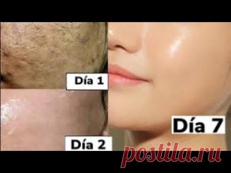 REPARA LA PIEL DAñADA / CIERRA POROS GRANDES / AANGIE