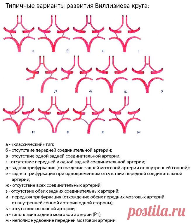 Виллизиев круг: анатомия, варианты развития, патология