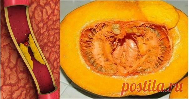 Прощай холестерин, повышенная глюкоза в крови!

Я использую это чудесное лечение, по крайней мере один раз в год...Результаты впечатляющие!

Это произошло несколько месяцев назад, когда мой друг показал мне

результаты анализа крови одного своего пациента, и я должен сказать, что это произвело на меня впечатление. Когда я увидел числа всех параметров крови: холестерин, мочевина, глюкоза крови, триглицериды и липиды — я был в шоке. Все они имели значения, которые далеко пре...