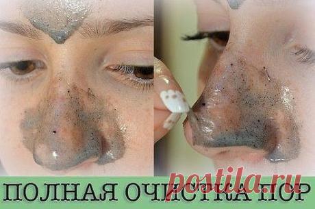 ПОЛНАЯ ОЧИСТКА ПОР 
Девочки! Кроме шуток, эта штука вычищает все черные точки, угри и сыпи. Просто потрясающий рецептик!! Если бы сама не проверила - никогда бы не поверила)) Вы просто обязаны ее попробовать!)) Эффект гарантирован. Как? Да очень просто! :) 
Дрожжевая маска 
Чтобы приготовить это эффективное средство от черных точек, смешайте трехпроцентную перекись водорода с дрожжами. Нанесите полученную смесь на Т-зону на десять минут. Смойте маску водой и протрите кожу кубиком льда, после