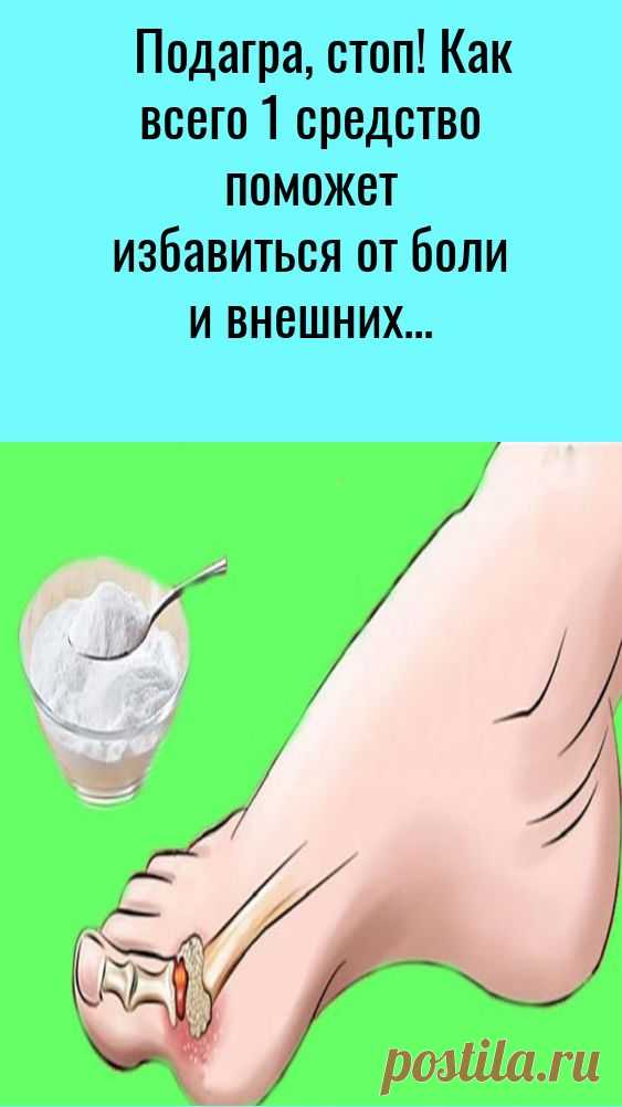 Подагра, стоп! Как всего 1 средство поможет избавиться от боли и внешних признаков. Эффект придет п