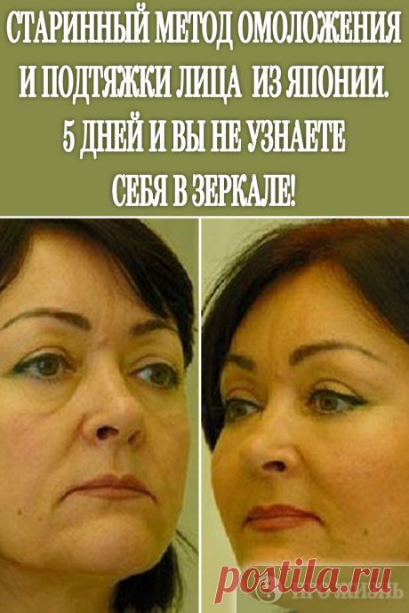 #омоложение #подтяжка #лица