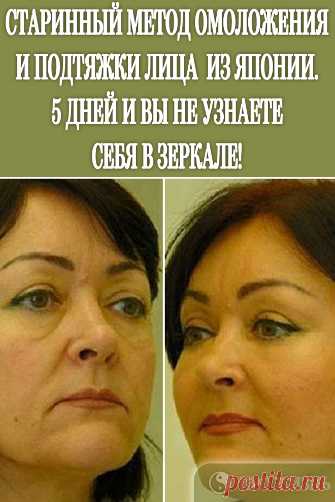 #омоложение #подтяжка #лица
