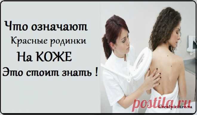 Что означают красные родинки на коже  


Наверняка вы тоже замечали у себя на теле красные точки, похожие на родинки. Как правило, они маленького размера и багрового цвета (иногда чуть светлее), чаще появляются в области шеи, на груди и …