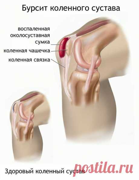 Почему болят колени: причины и следствия