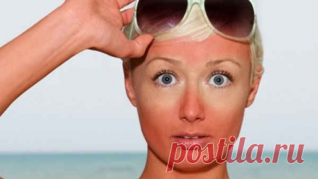 Что делать при солнечном ожоге. Лечение зуда, волдырей, отека