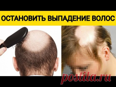 Эти способы помогли мне ОСТАНОВИТЬ ВЫПАДЕНИЕ ВОЛОС. Волосы растут с новой силой в 10 раз быстрей