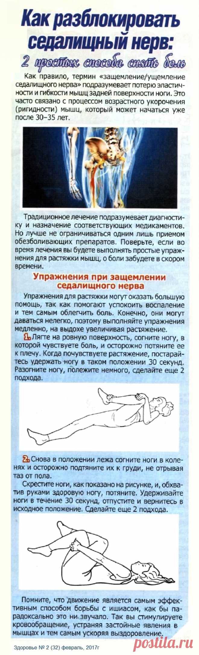 Как разблокировать седалищный нерв