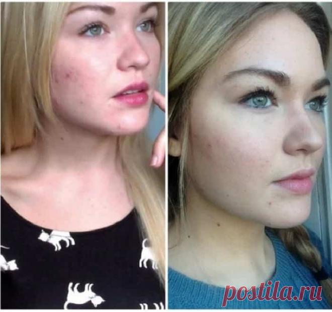 Давно моя кожа не была в настолько шикарном состоянии! Хочется прикасаться к ней вечно… -