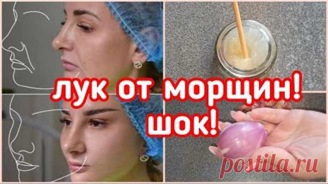 У Меня НЕТ МОРЩИН! Делаю ЧЕРЕЗ ДЕНЬ и лицо Молодеет даже в 70 лет! Луковая КРЕМ МАСКА