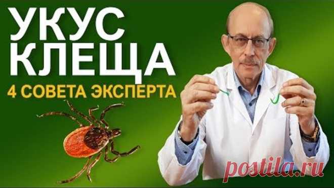 Что делать если Вас укусил клещ - последние Европейские рекомендации CDC и IDSA