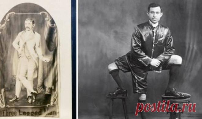 10 страшных и удивительных аномалий, которые преследуют человека.  ТРИ НОГИ.