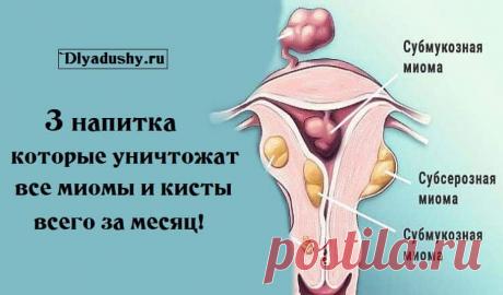 3 напитка которые уничтожат все миомы и кисты всего за месяц!