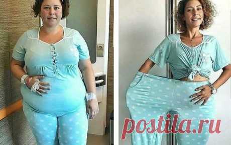 Как избавиться от жирного живота в период климакса: 3 простых упражнения для плоского и подтянутого живота  →
Жир на животе и боках в менопаузу появляется не только у полных женщин.
Даже худышки могут столкнуться с этой проблемой.
На самом деле, жир на животе в период менопаузы – это нормальное явление.
Но существует несколько действенных способов сделать живот плоским и подтянутым.
Как избавиться от жира на животе при климаксе
В первую очередь, важно следить за питанием.
Если вы едите нездоро…