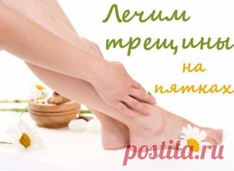 ЛЕЧИМ ПЯТОЧКИ | Женский журнал