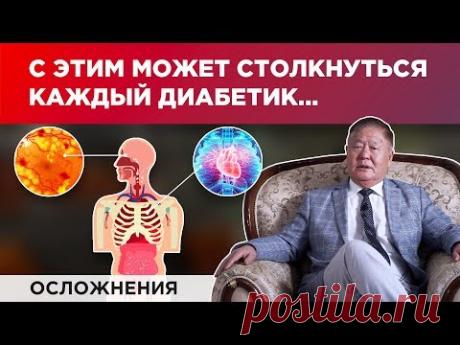 Что будет если «убегать» от диабета?