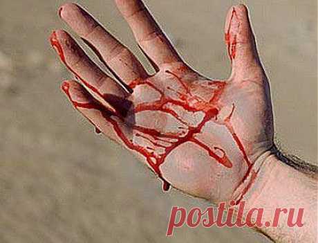 (+1) - Острые кровотечения у детей - первая помощь | Первая помощь